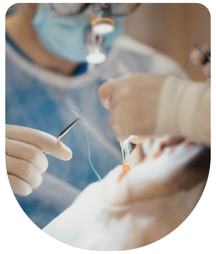 extração de dente do siso com segurança