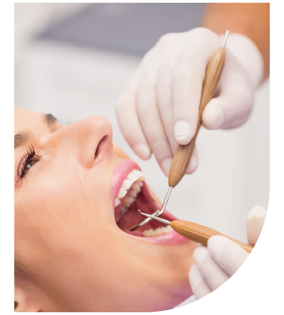restauração dentária após tratamento de canal