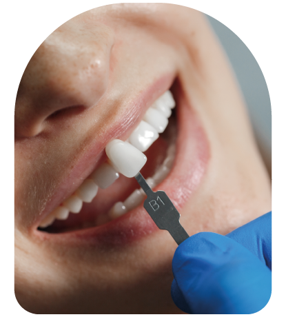 Paciente durante tratamento de implantes dentários